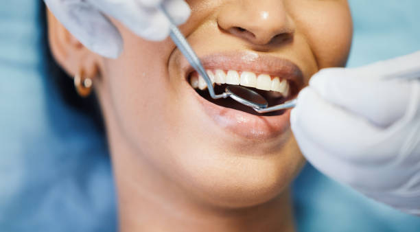Best Tooth Infection Emergency Dentist  in East Oakdale, CA